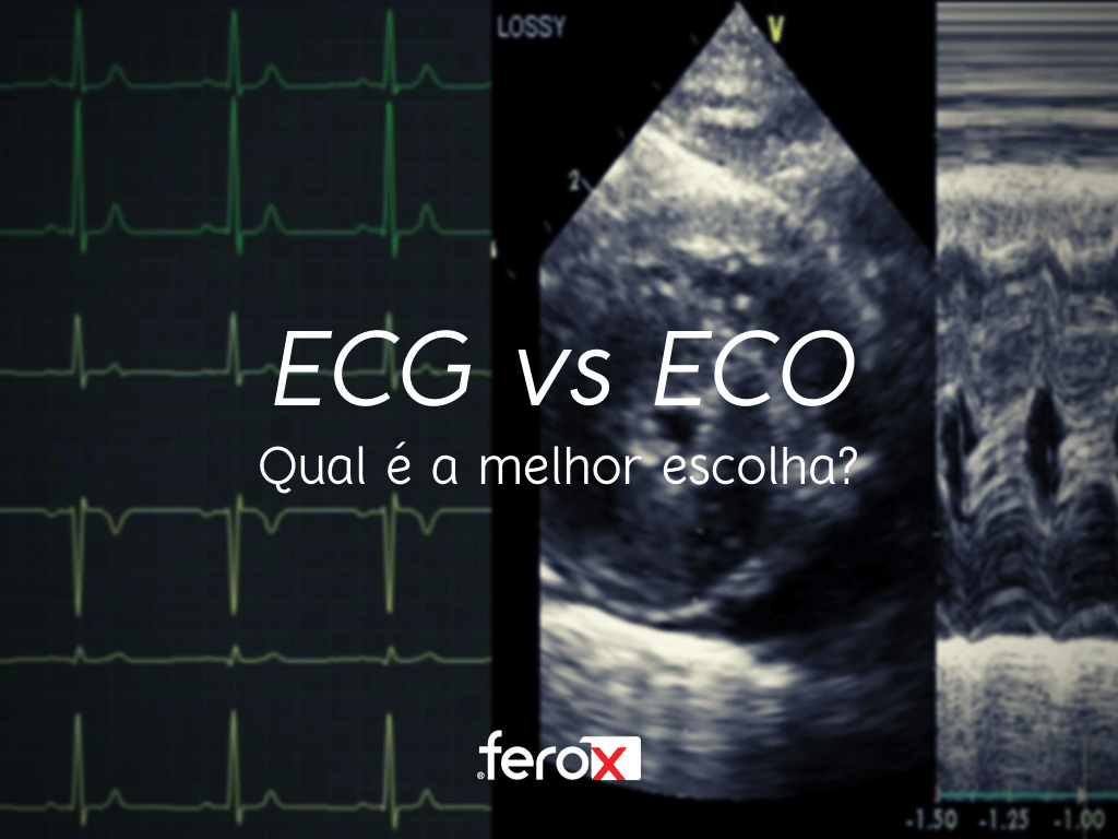 O Que é um Eletrocardiograma e Ecocardiograma?